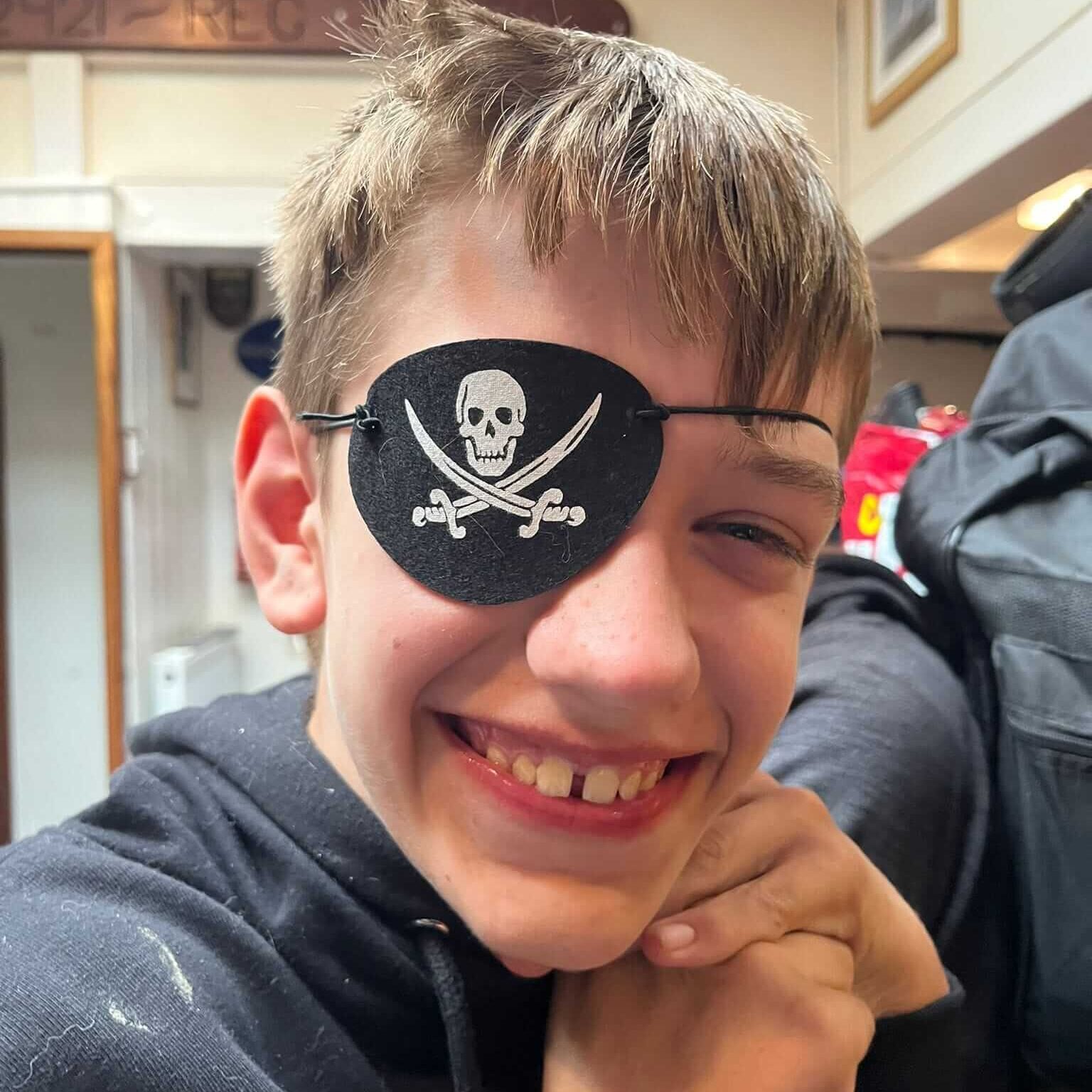 A boy is smiling at the camera with his hands clasped under his chin. He is wearing a dark coloured top and a pirate eye patch.
